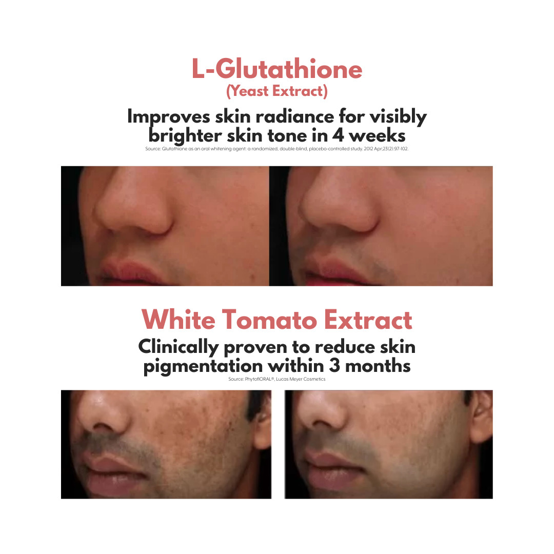 Aura White Ultra - Best Skin Whitening Supplement Singapore | L-Glutat Aura White Ultra - Best Skin Whitening Supplement Singapore | L-Glutat