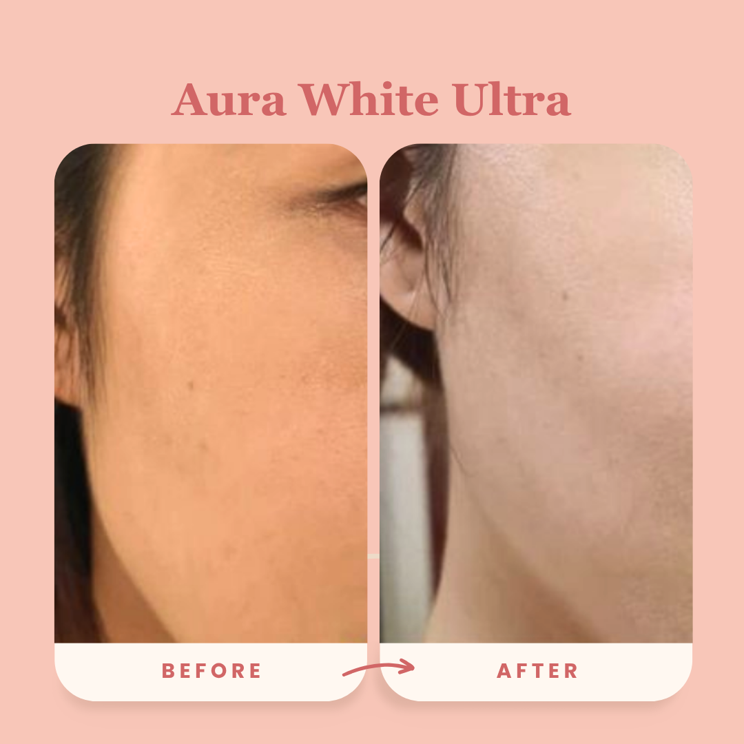 Best-Seller Award-Winning Duo: Aura White Ultra + Block It Bundle