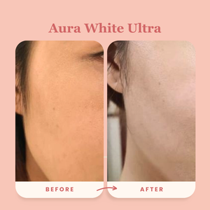 Best-Seller Award-Winning Duo: Aura White Ultra + Block It Bundle