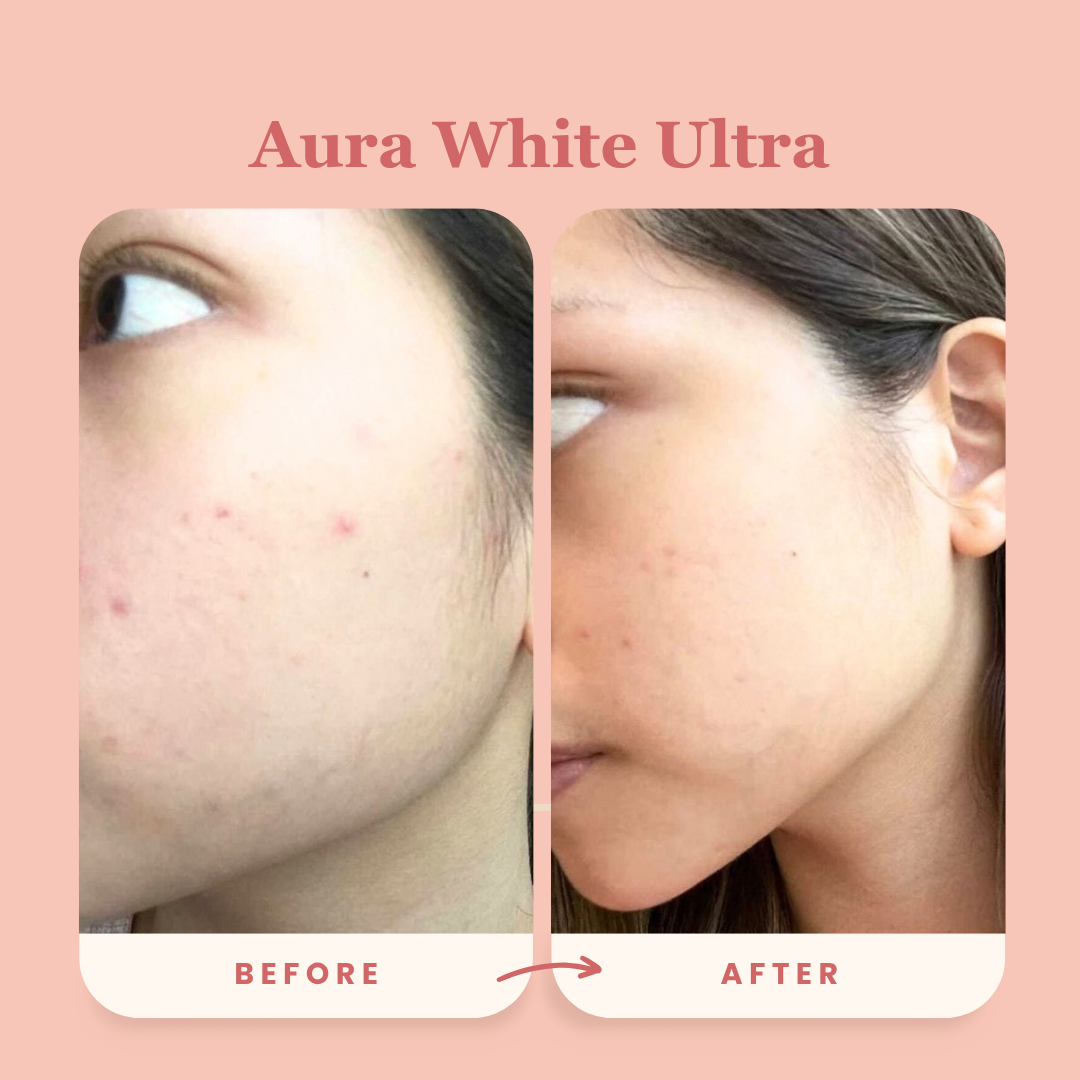 Best-Seller Award-Winning Duo: Aura White Ultra + Block It Bundle