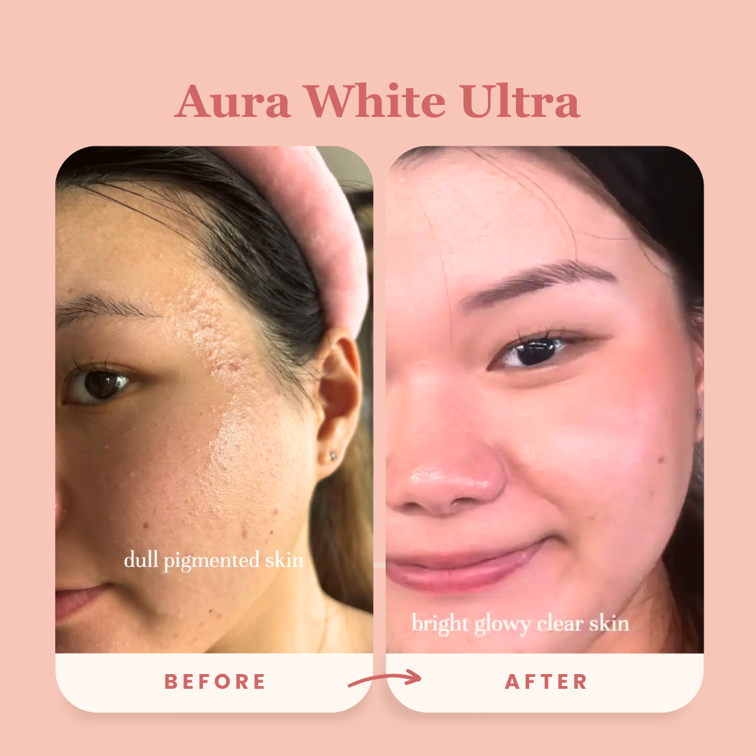 Best-Seller Award-Winning Duo: Aura White Ultra + Block It Bundle