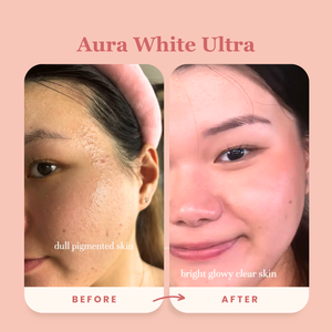 Best-Seller Award-Winning Duo: Aura White Ultra + Block It Bundle